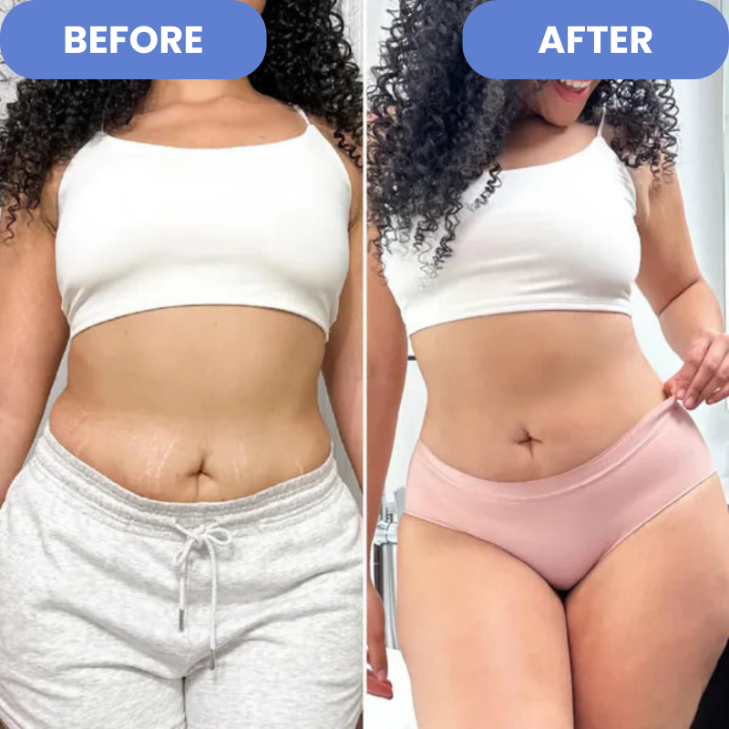 Velina™ - Anti--Entferner | 50 % RABATT