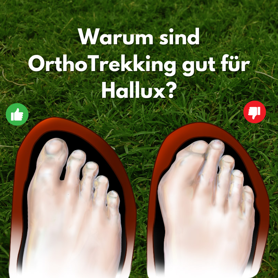 OrthoTrekking Hallux –Hallux Valgus Trekking.