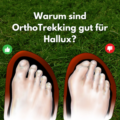 OrthoTrekking Hallux –Hallux Valgus Trekking.