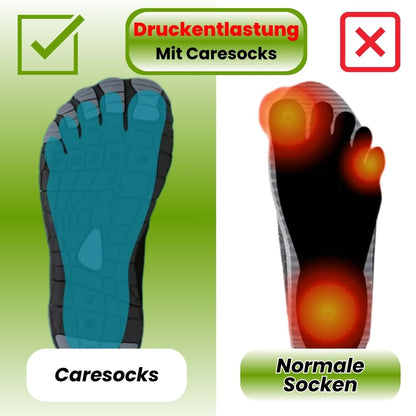 Caresocks – Kompressionsstrümpfe